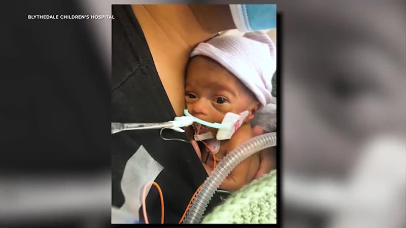 A little boy spent the first 22 months of his life inside hospital walls after he was born...